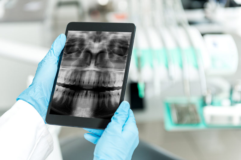 Dentist examines dental digital x-ray at SW Calgary dental office in Marda Loop.